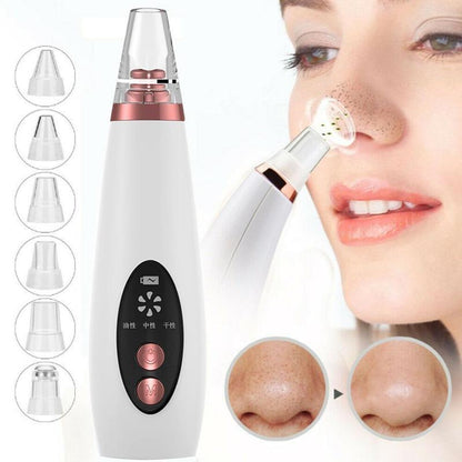 Blackhead Pore Vacuum Cleaner Nose Cleanser Blackheads Remover Blackhead Acne Removal Button Face Suction Beauty Skin Care Tool - Thriver Trend